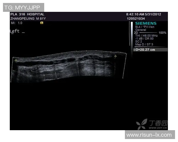 利拉德深静脉血栓痊愈有望在季后赛首轮G2或G3复出 利拉德深静脉血栓痊愈有望在季后赛首轮G2或G3复出